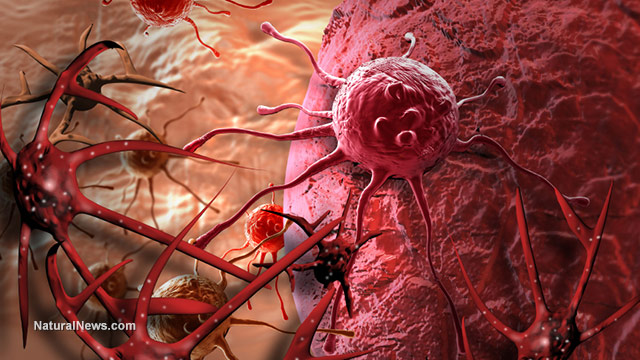 Cancer-Cell-Tumor