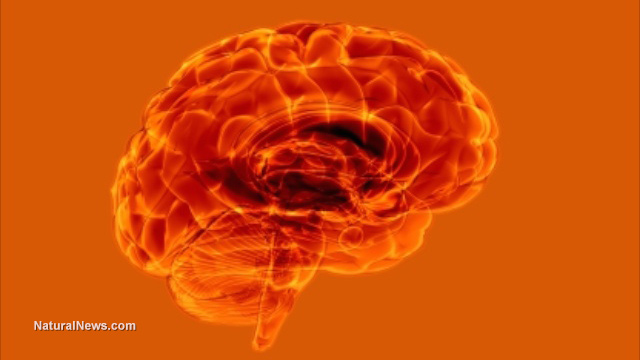 Brain-Scan-Orange